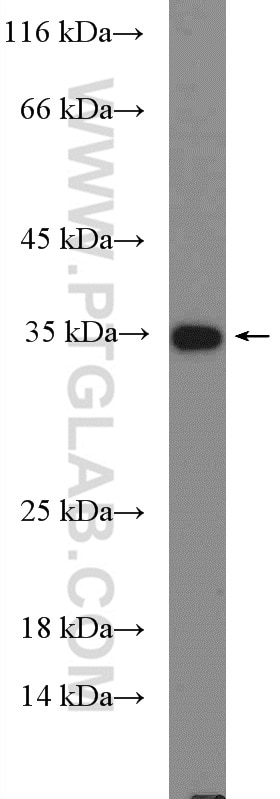 Western Blot (WB) analysis of Recombinant protein using IL-5 Polyclonal antibody (26677-1-AP)