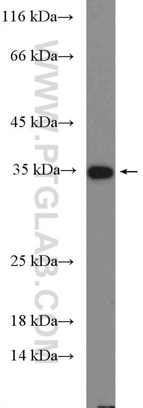 WB analysis of Recombinant protein using 26677-1-AP