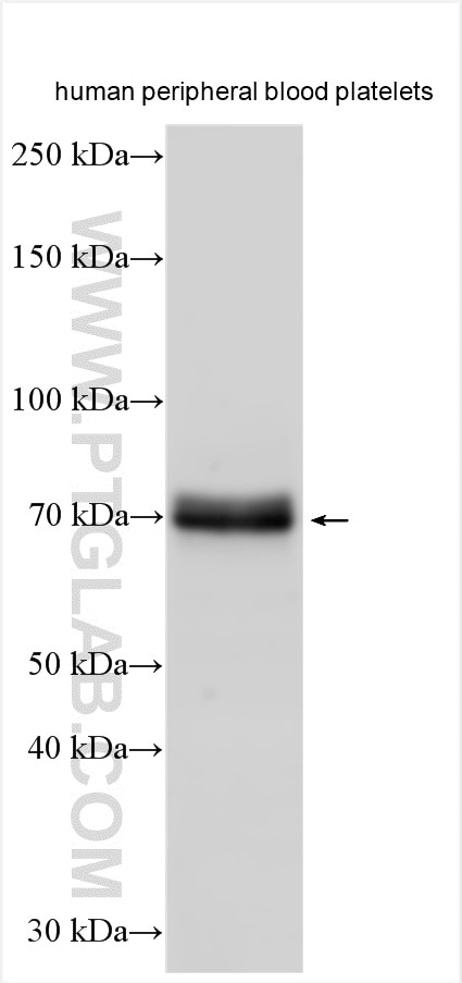 WB analysis of human peripheral blood platelets using 12655-1-AP