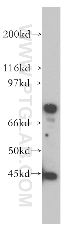 Western Blot (WB) analysis of Jurkat cells using IL-5RA Polyclonal antibody (12655-1-AP)
