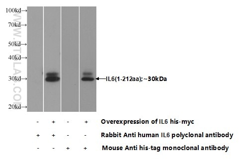 IL-6 Polyclonal antibody