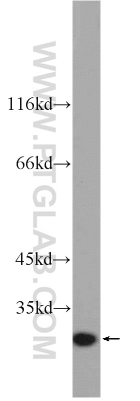 IL-6 Polyclonal antibody