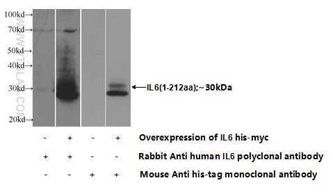 IL-6 Polyclonal antibody