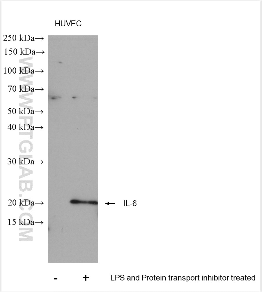 Western Blot (WB) analysis of various lysates using IL-6 Polyclonal antibody (21865-1-AP)