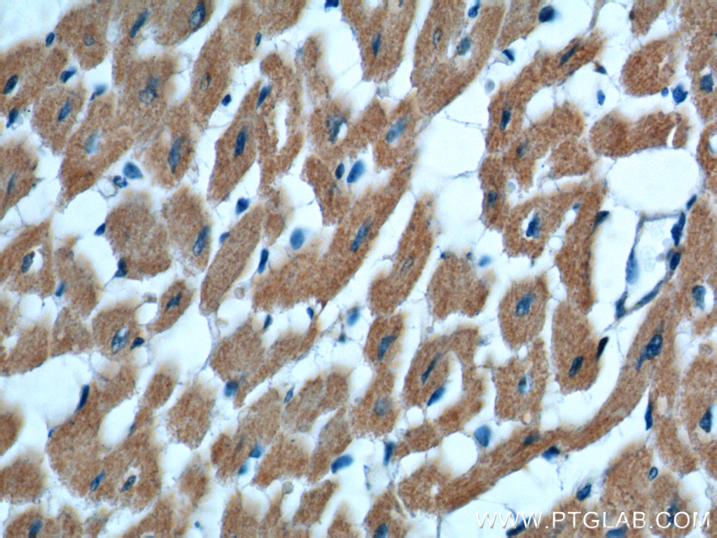 IL-6 Monoclonal antibody