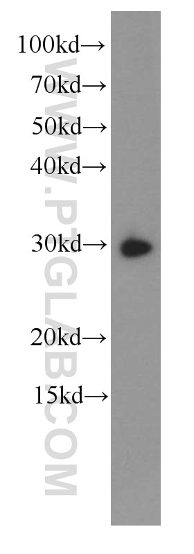 IL-6 Monoclonal antibody