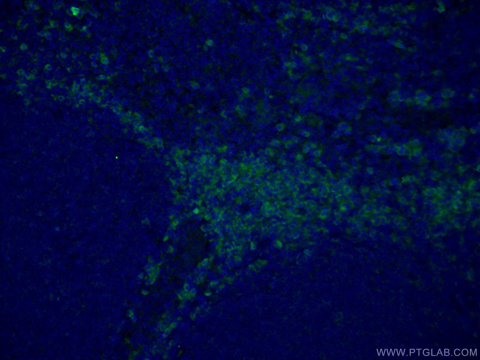Immunofluorescence (IF) / fluorescent staining of human tonsillitis tissue using IL-6R alpha Polyclonal antibody (23457-1-AP)