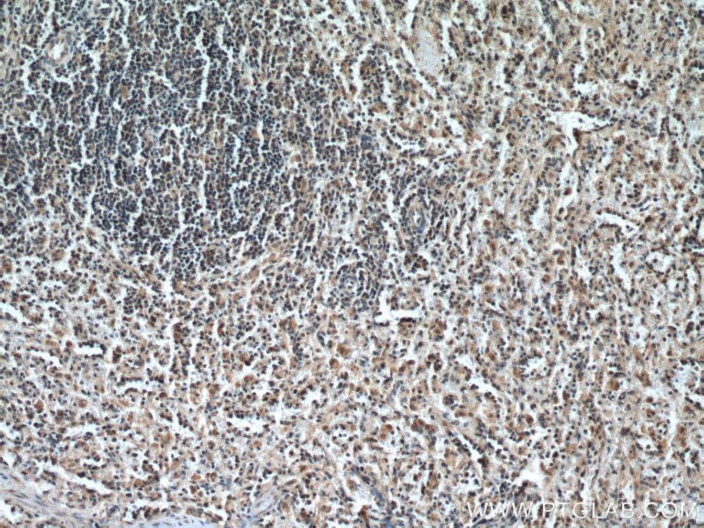 Immunohistochemistry (IHC) staining of human spleen tissue using IL-6R alpha Polyclonal antibody (23457-1-AP)