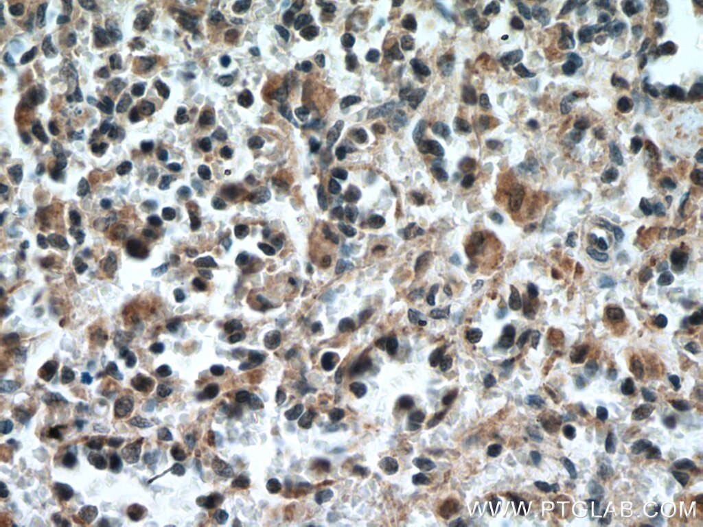 Immunohistochemistry (IHC) staining of human spleen tissue using IL-6R alpha Polyclonal antibody (23457-1-AP)