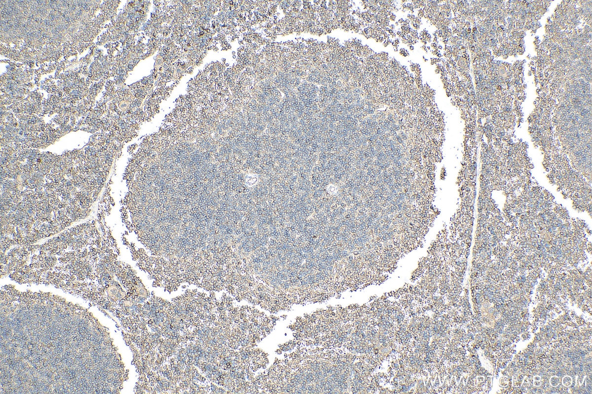 Immunohistochemistry (IHC) staining of mouse spleen tissue using CD126/IL-6R alpha Polyclonal antibody (23457-1-AP)