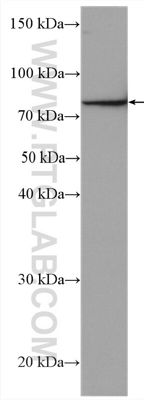 Western Blot (WB) analysis of Jurkat cells using IL-6R alpha Polyclonal antibody (23457-1-AP)