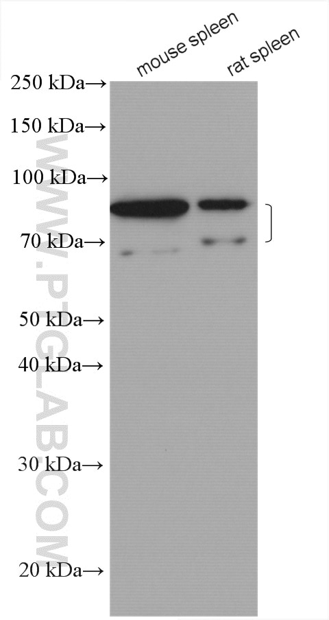 Western Blot (WB) analysis of various lysates using IL-6R alpha Polyclonal antibody (23457-1-AP)