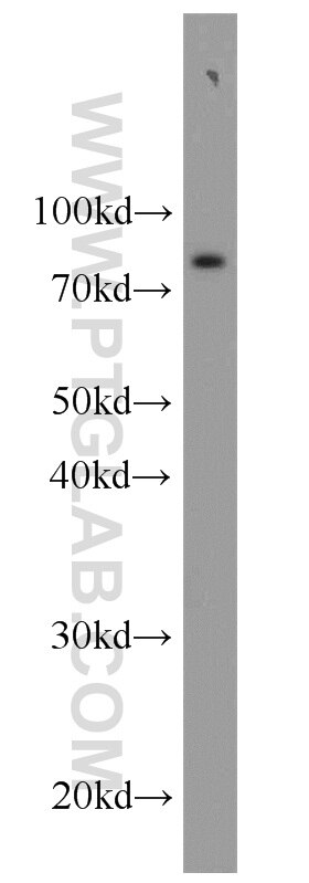 IL-6R alpha Polyclonal antibody