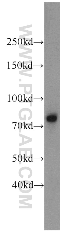 Western Blot (WB) analysis of mouse spleen tissue using IL-6R alpha Polyclonal antibody (23457-1-AP)