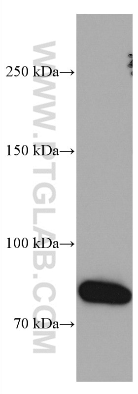 Western Blot (WB) analysis of human spleen tissue using CD126/IL-6R alpha Monoclonal antibody (66855-1-Ig)
