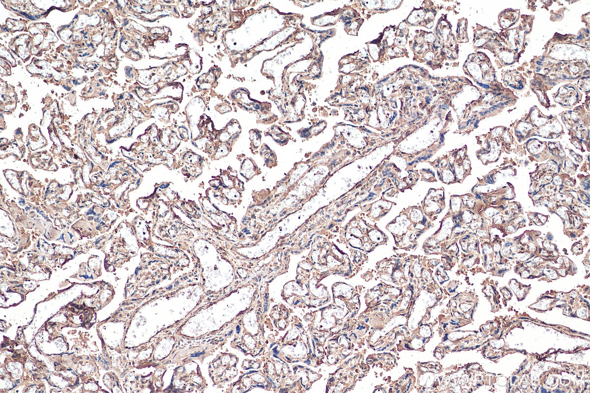 Immunohistochemistry (IHC) staining of human placenta tissue using gp130 Monoclonal antibody (67766-1-Ig)