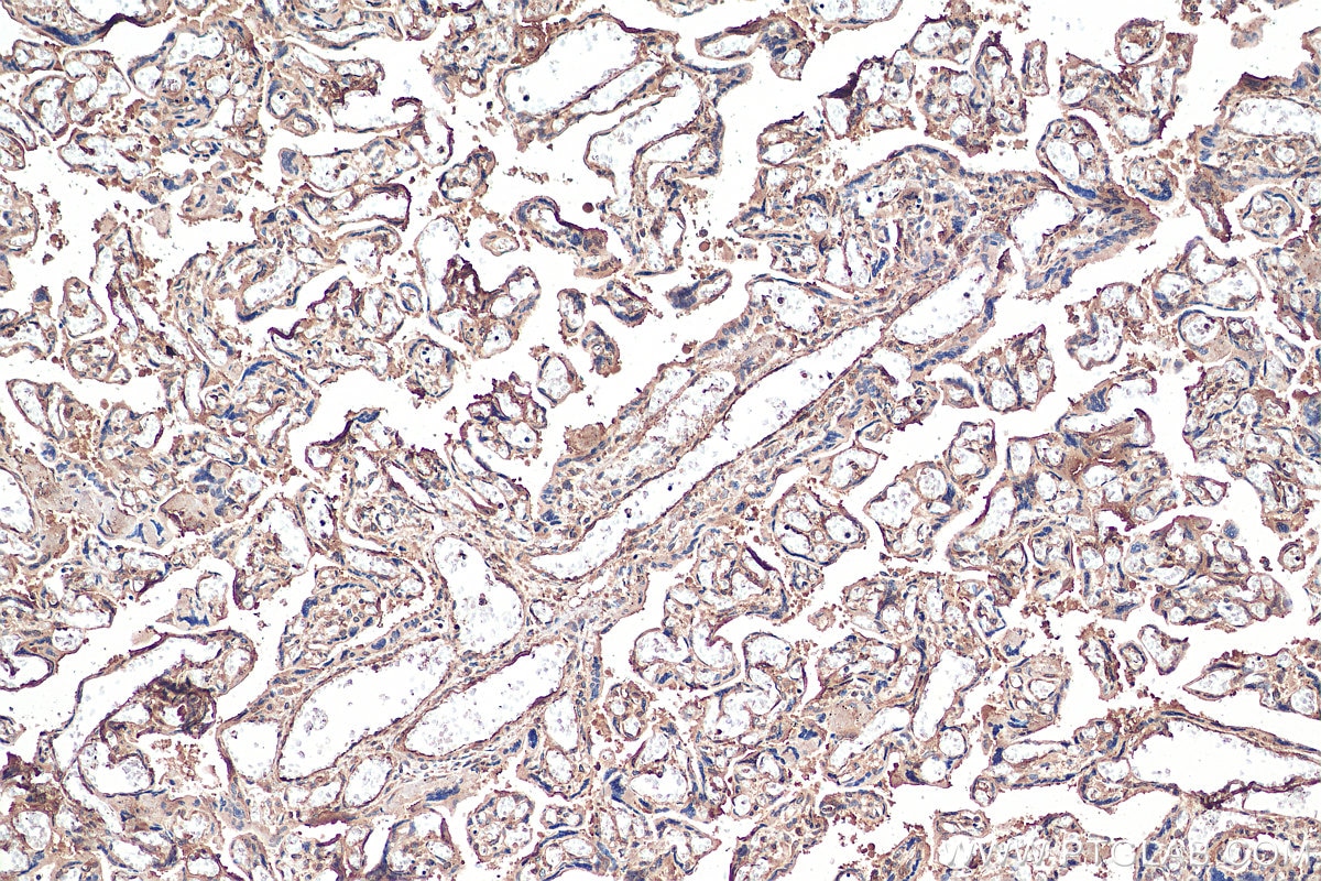 Immunohistochemistry (IHC) staining of human placenta tissue using gp130 Monoclonal antibody (67766-1-Ig)