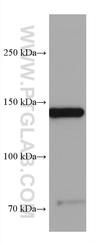 Western Blot (WB) analysis of NCCIT cells using gp130 Monoclonal antibody (67766-1-Ig)