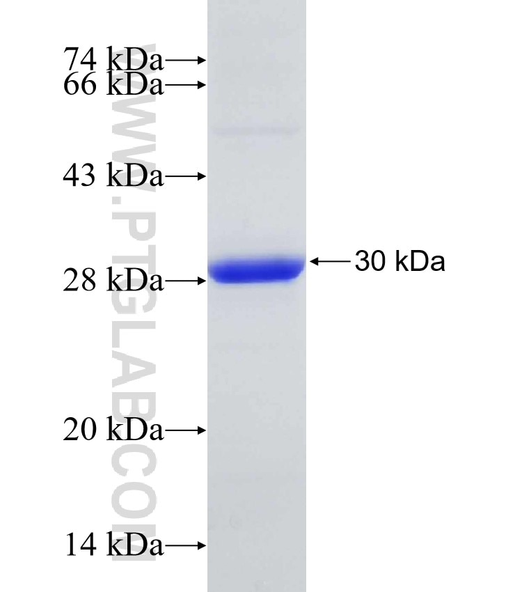IL6ST fusion protein Ag31678 SDS-PAGE IL6ST fusion protein Ag31678 SDS-PAGE