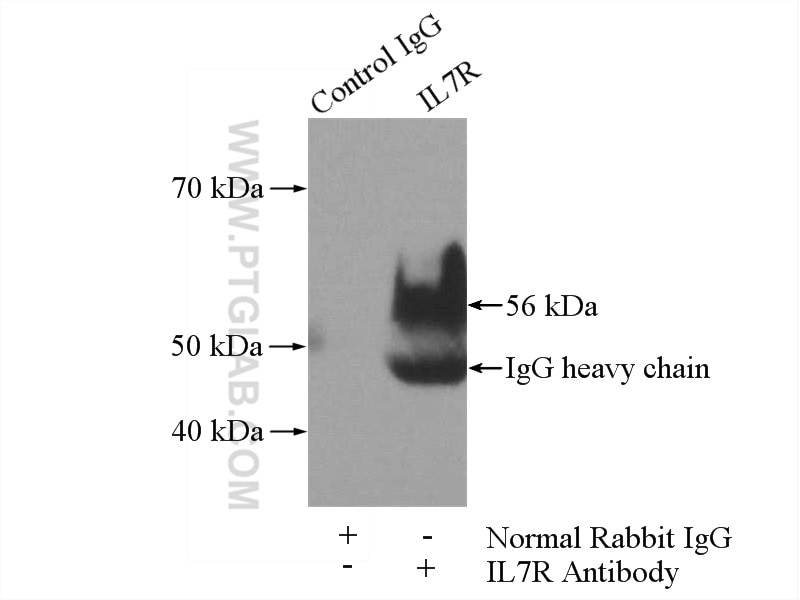Immunoprecipitation (IP) experiment of K-562 cells using CD127/IL-7R Polyclonal antibody (17626-1-AP)