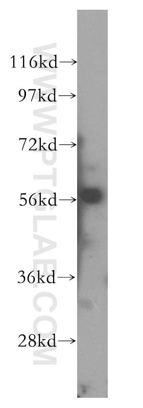 Western Blot (WB) analysis of K-562 cells using CD127/IL-7R Polyclonal antibody (17626-1-AP)