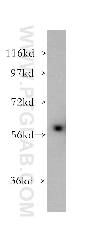 WB analysis of mouse thymus using 17626-1-AP