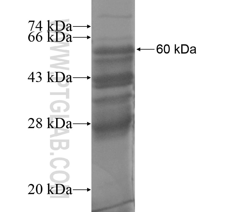 IL-7R fusion protein Ag11844 SDS-PAGE