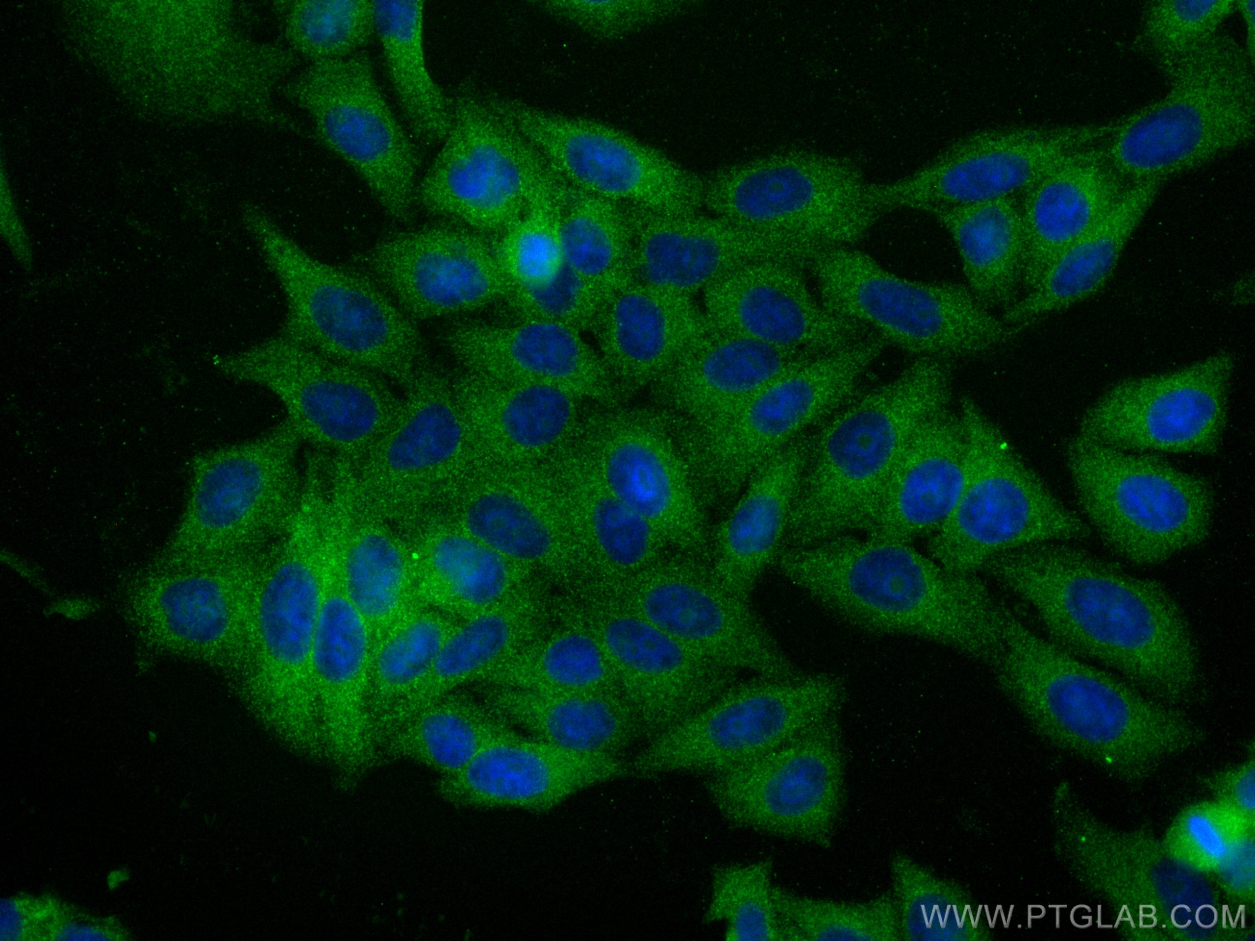 Immunofluorescence (IF) / fluorescent staining of HepG2 cells using CXCR2 Polyclonal antibody (20634-1-AP)