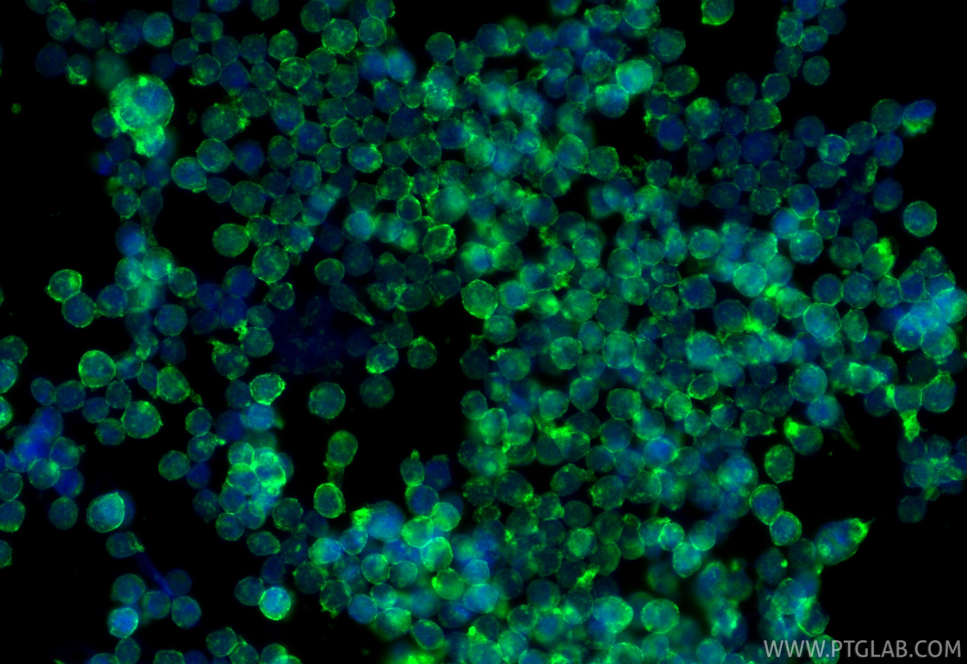 Immunofluorescence (IF) / fluorescent staining of THP-1 cells using CXCR2 Polyclonal antibody (20634-1-AP)