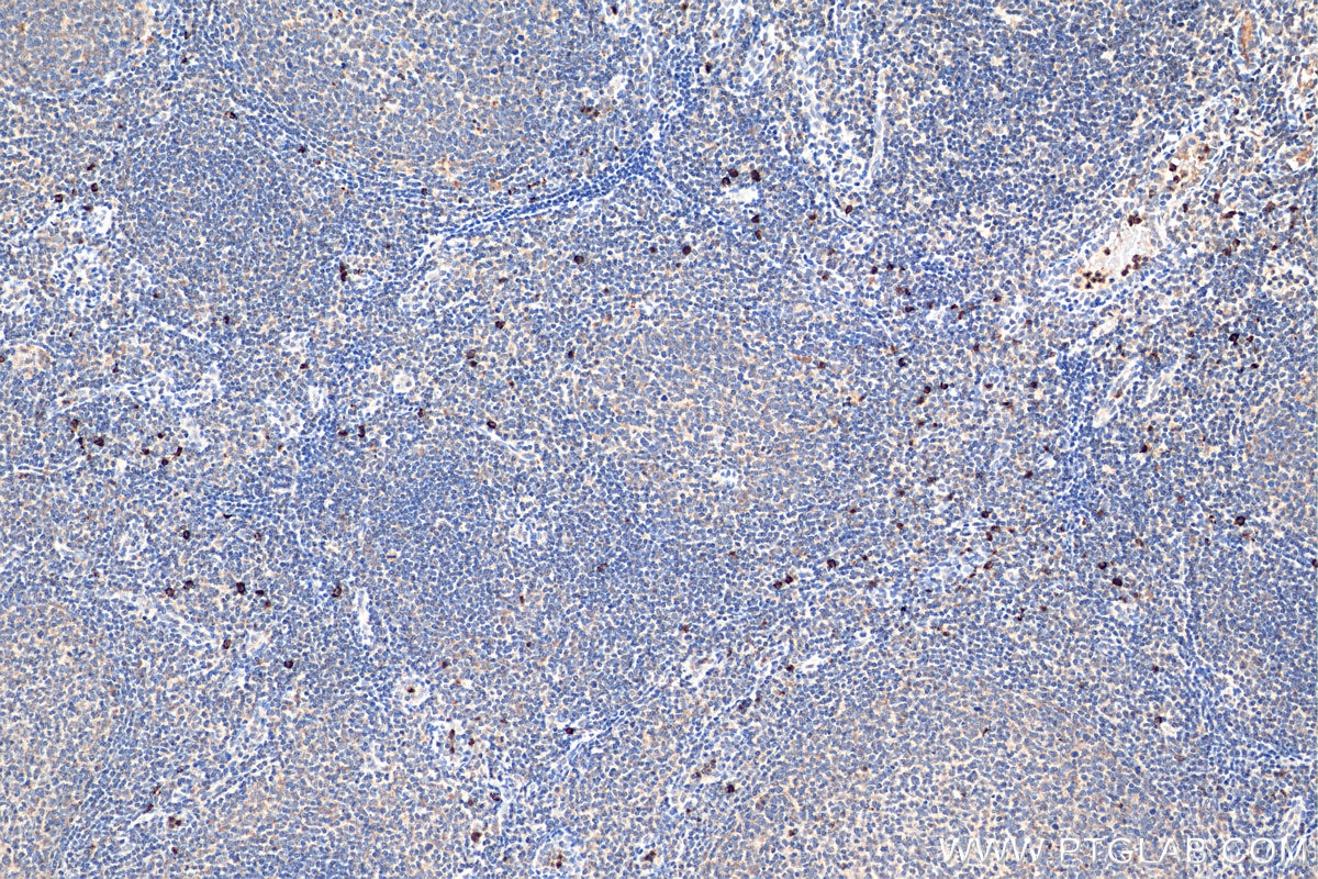 Immunohistochemistry (IHC) staining of human tonsillitis tissue using CXCR2 Polyclonal antibody (20634-1-AP)