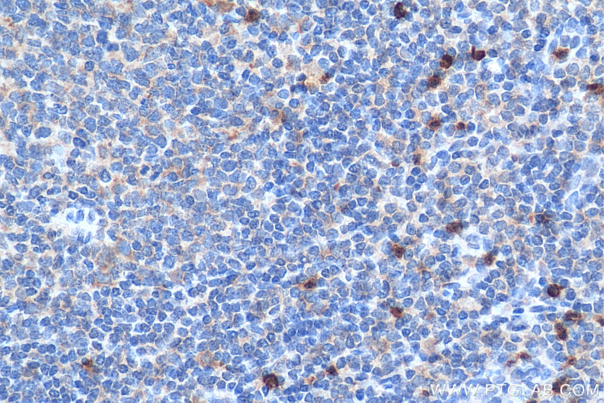 Immunohistochemistry (IHC) staining of human tonsillitis tissue using CXCR2 Polyclonal antibody (20634-1-AP)
