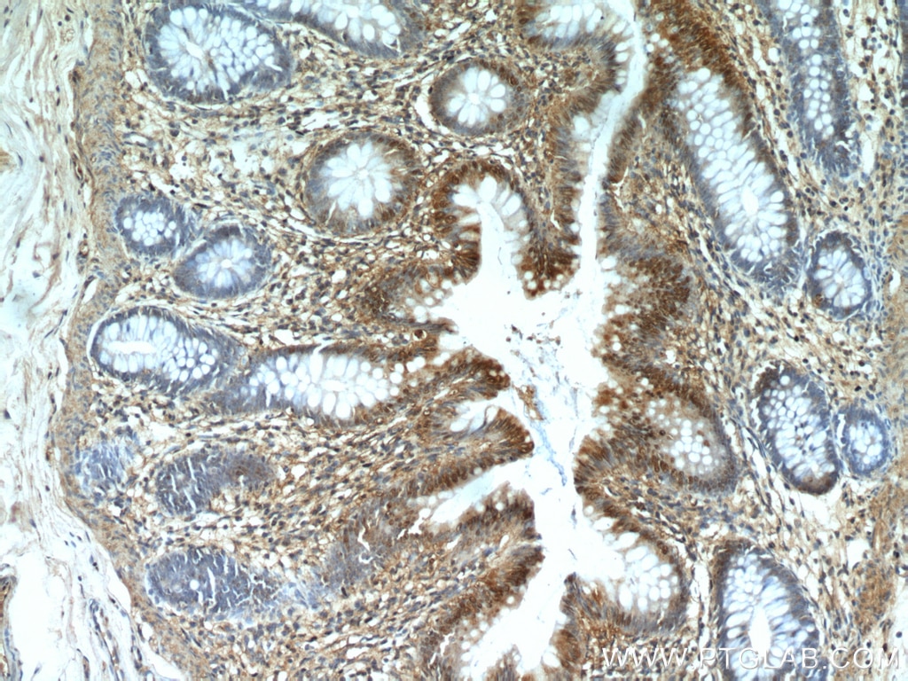 Immunohistochemistry (IHC) staining of human colon tissue using CXCR2 Polyclonal antibody (20634-1-AP)