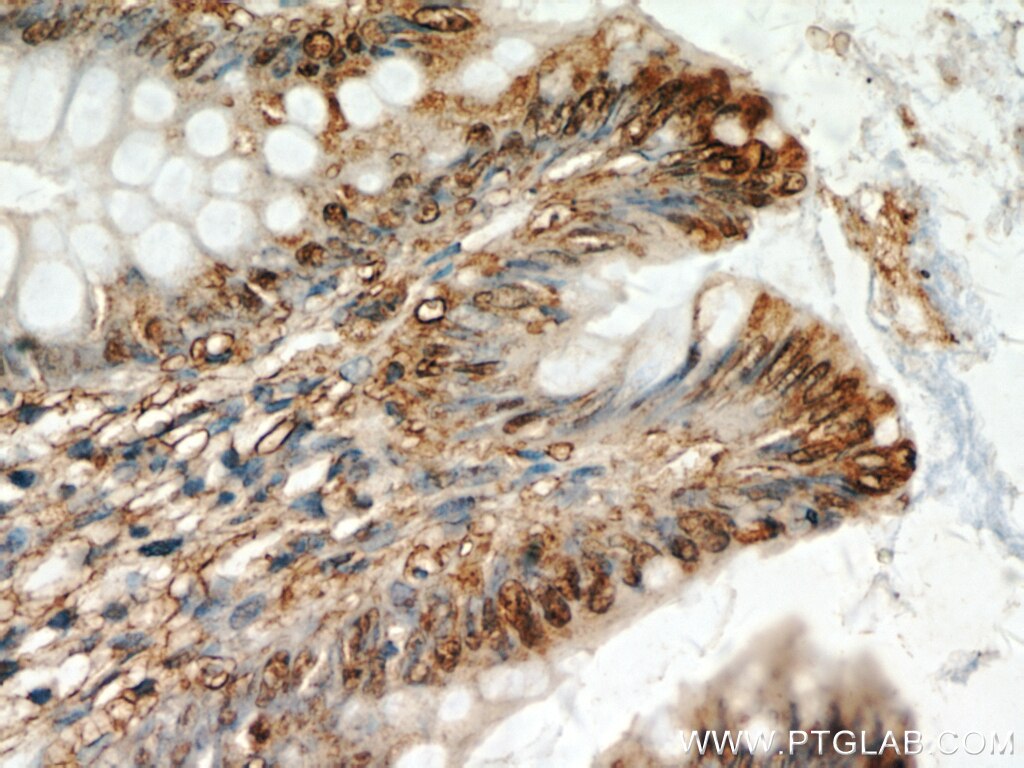 Immunohistochemistry (IHC) staining of human colon tissue using CXCR2 Polyclonal antibody (20634-1-AP)