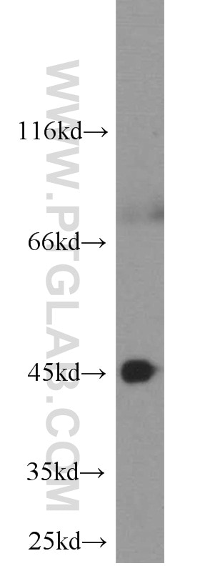 Western Blot (WB) analysis of COLO 320 cells using CXCR2 Polyclonal antibody (20634-1-AP)