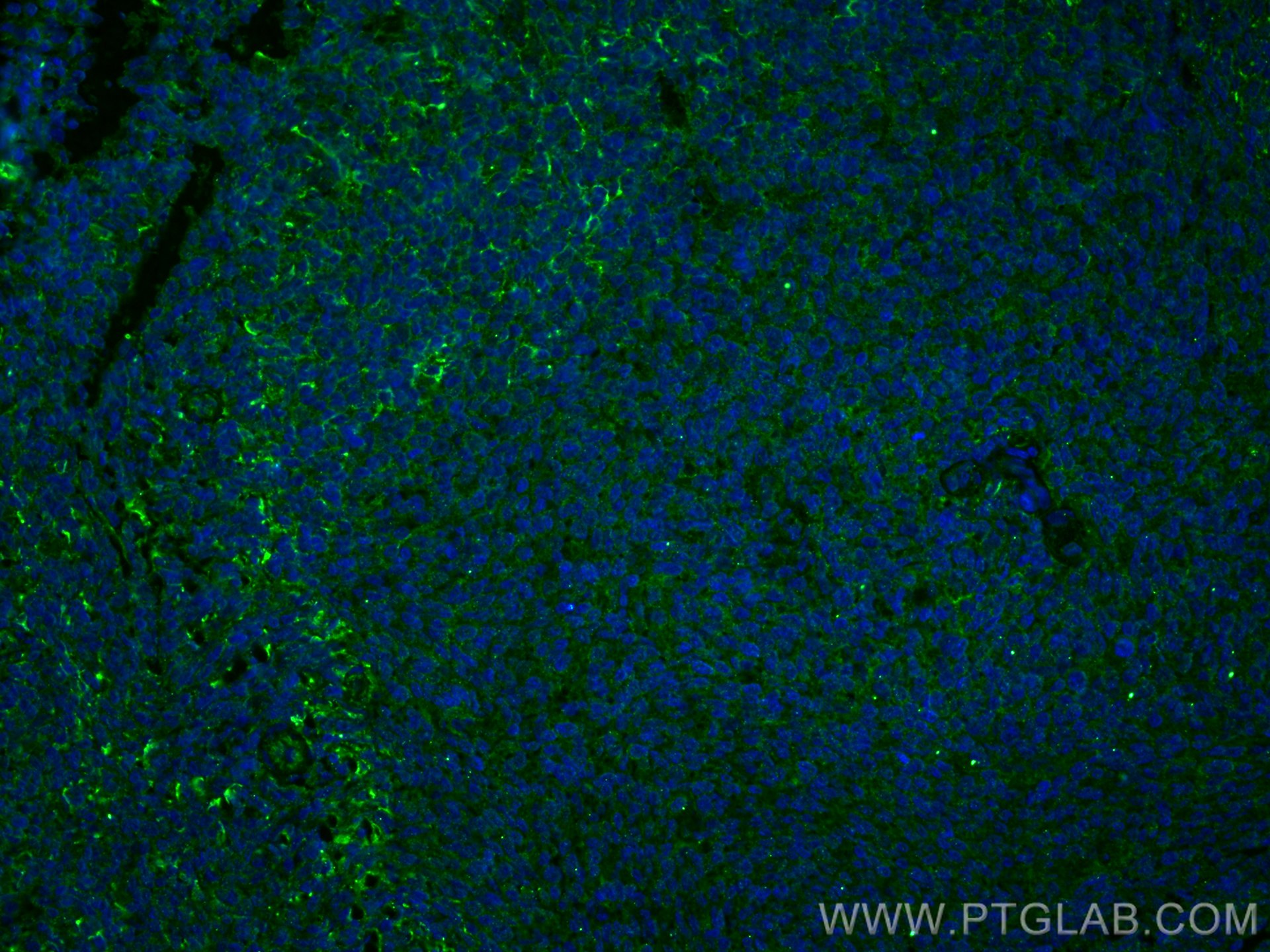 Immunofluorescence (IF) / fluorescent staining of human tonsillitis tissue using IL-9 Monoclonal antibody (66144-1-Ig)