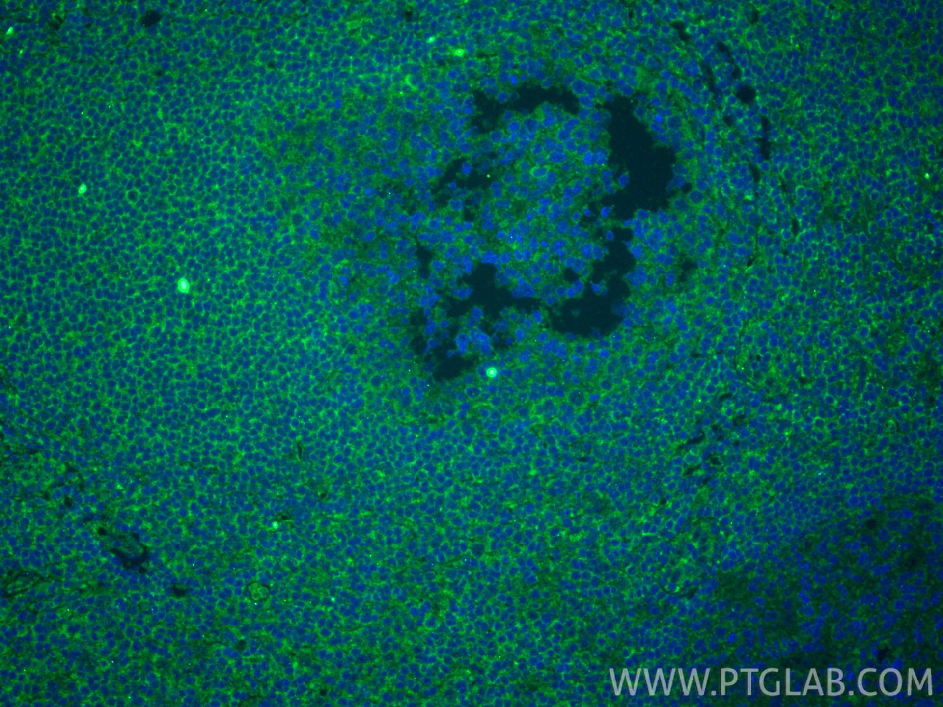 Immunofluorescent analysis of (4% PFA) fixed paraffin-embedded human tonsillitis tissue using IL-9 antibody (66144-1-Ig, Clone: 1F3A11 ) at dilution of 1:800 and CoraLite®488-Conjugated Goat Anti-Mouse IgG(H+L) (SA00013-1). Heat mediated antigen retrieval with Tris-EDTA buffer (pH 9.0). Immunofluorescence (IF) / fluorescent staining of human tonsillitis tissue using IL-9 Monoclonal antibody (66144-1-Ig)