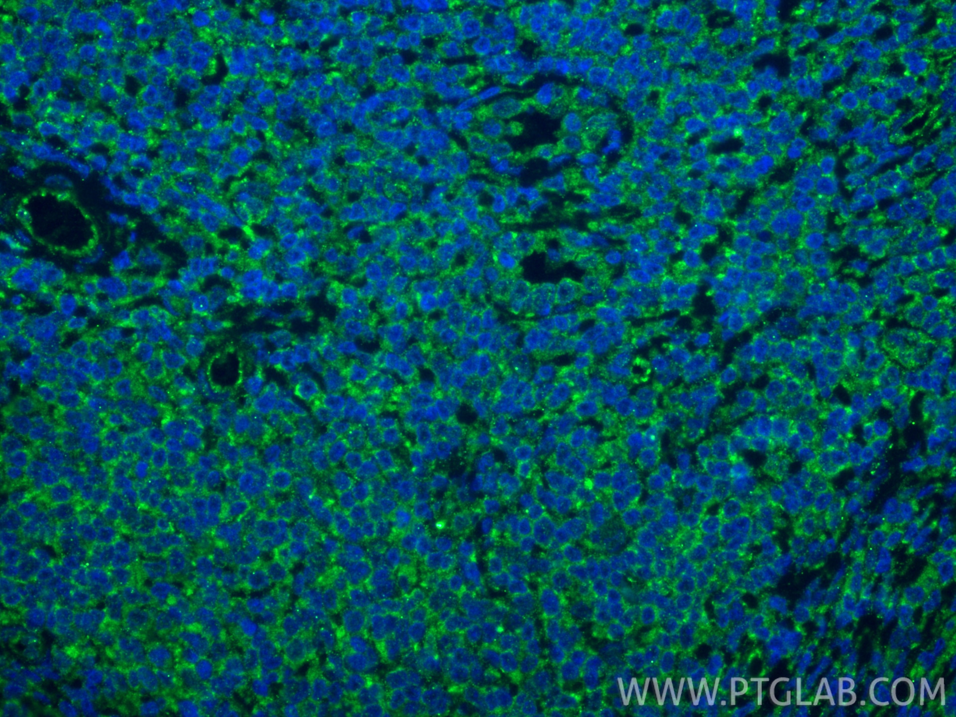 Immunofluorescent analysis of (4% PFA) fixed paraffin-embedded human tonsillitis tissue using IL-9 antibody (66144-1-Ig, Clone: 1F3A11 ) at dilution of 1:800 and CoraLite®488-Conjugated Goat Anti-Mouse IgG(H+L) (SA00013-1). Heat mediated antigen retrieval with Tris-EDTA buffer (pH 9.0). Immunofluorescence (IF) / fluorescent staining of human tonsillitis tissue using IL-9 Monoclonal antibody (66144-1-Ig)