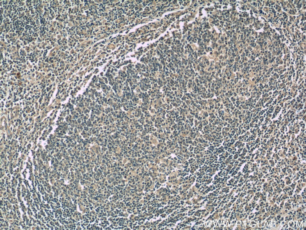 Immunohistochemistry (IHC) staining of human tonsillitis tissue using IL-9 Monoclonal antibody (66144-1-Ig)