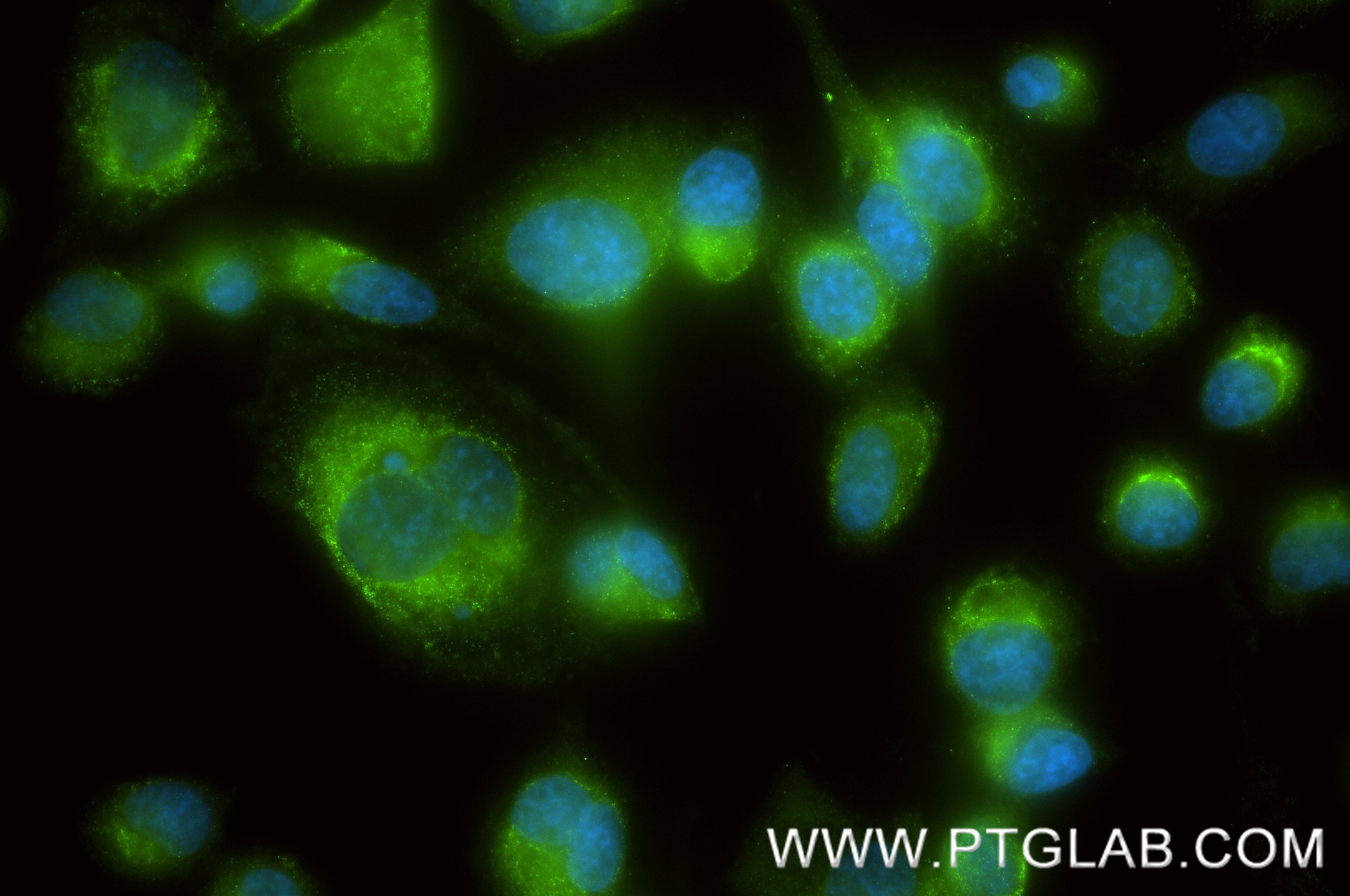 IF Staining of PC-3 using 87379-1-RR (same clone as 87379-1-PBS) Immunofluorescence (IF) / fluorescent staining of PC-3 cells using IL9R Recombinant monoclonal antibody (87379-1-RR)
