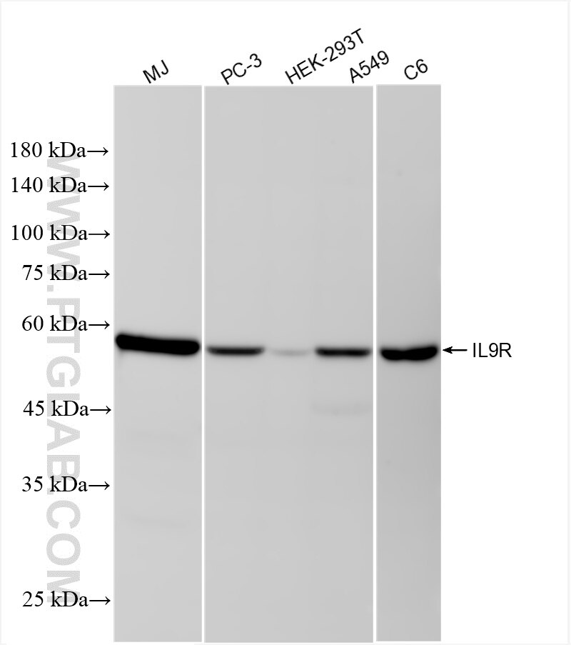 Western Blot (WB) analysis of various lysates using IL9R Recombinant monoclonal antibody (87379-1-RR)