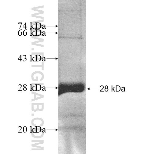 IL9R fusion protein Ag11209 SDS-PAGE