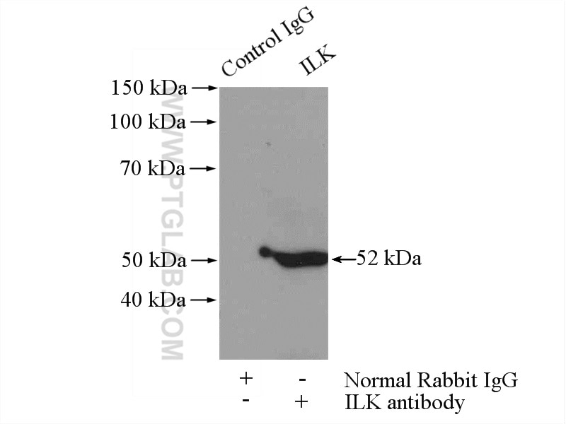 Immunoprecipitation (IP) experiment of mouse kidney tissue using ILK Polyclonal antibody (12955-1-AP)
