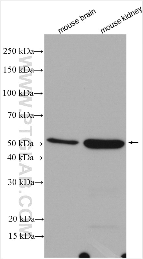 Western Blot (WB) analysis of various lysates using ILK Polyclonal antibody (12955-1-AP)