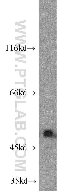 ILK Polyclonal antibody