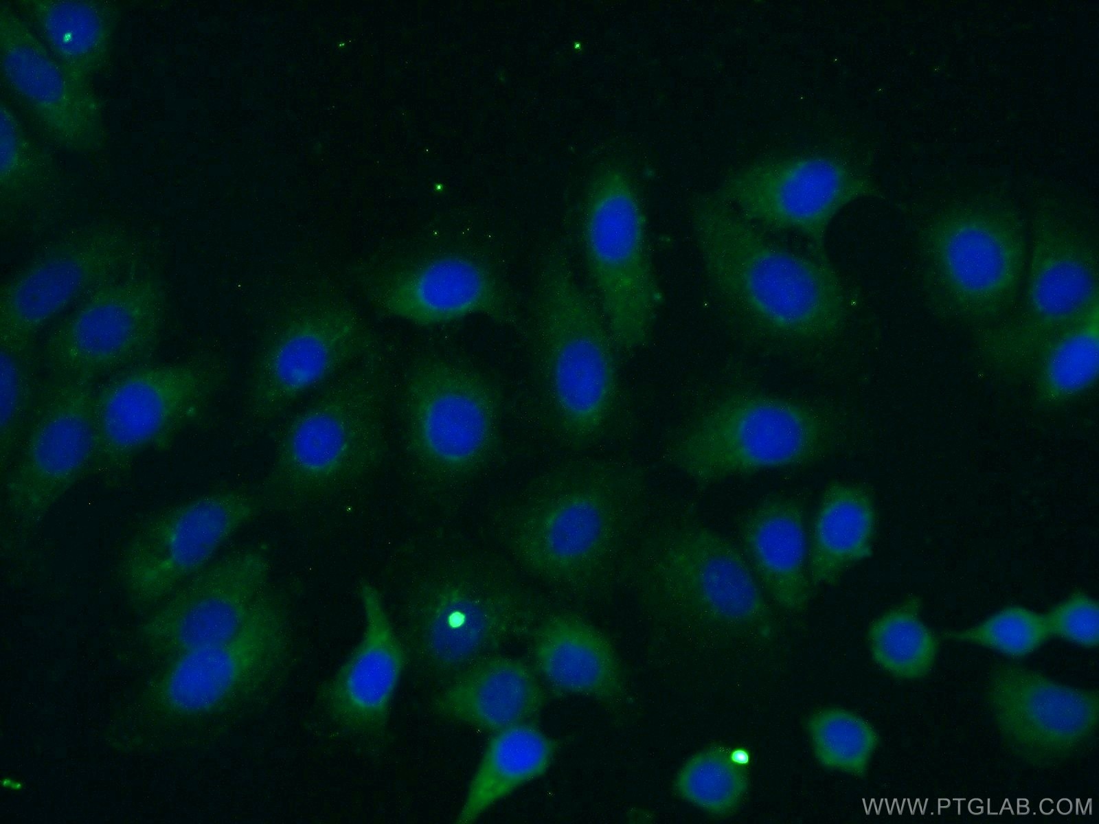 Immunofluorescence (IF) / fluorescent staining of MCF-7 cells using ILK Polyclonal antibody (24926-1-AP)