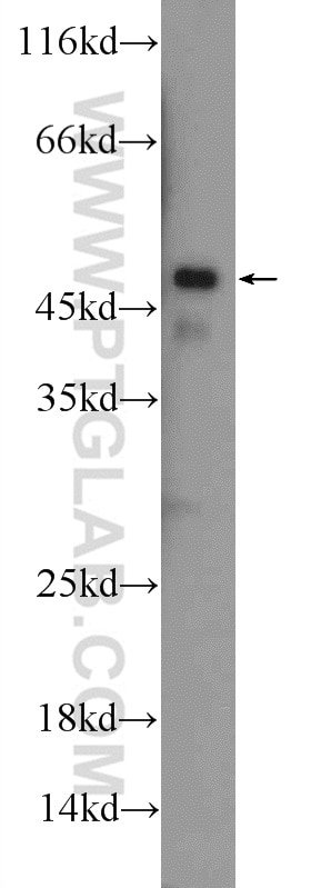 Western Blot (WB) analysis of mouse heart tissue using ILK Polyclonal antibody (24926-1-AP)