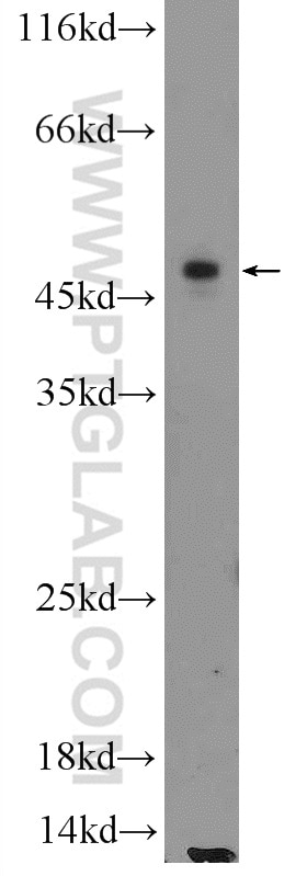 Western Blot (WB) analysis of MCF-7 cells using ILK Polyclonal antibody (24926-1-AP)