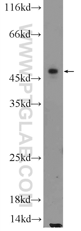 WB analysis of MCF-7 using 24926-1-AP