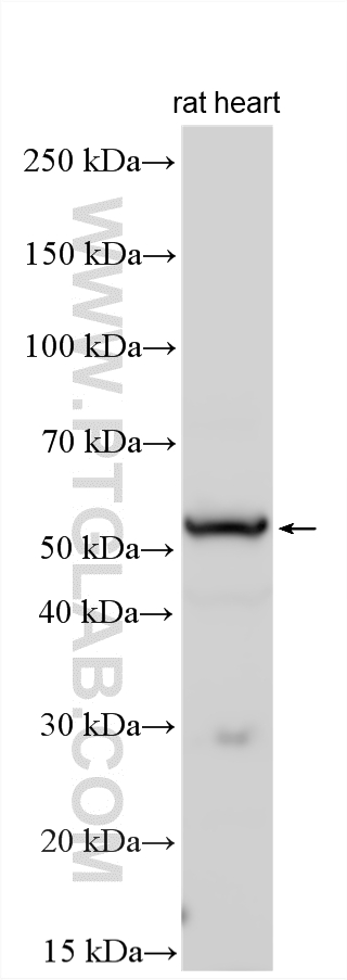 Western Blot (WB) analysis of various lysates using ILK Polyclonal antibody (24926-1-AP)