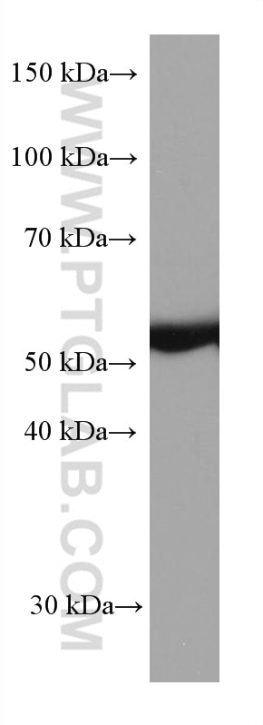 Western Blot (WB) analysis of human peripheral blood platelets using ILK Monoclonal antibody (67724-1-Ig)